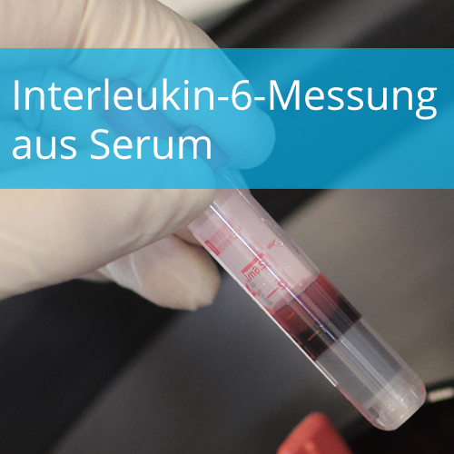 Interleukin-6-Messung aus Serum