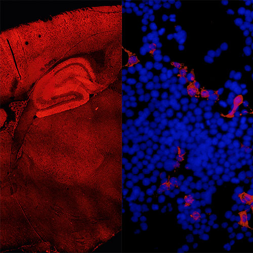 Diagnostics of neural antibodies at Labor Krone