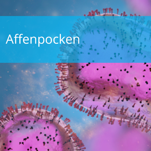 Affenpocken (Monkeypox virus MPXV)